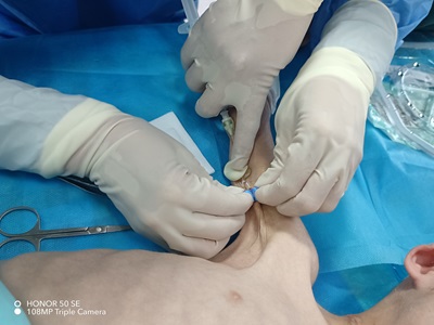 新突破丨啪啪啦
儿科二病区开展首例PICC原位换管置管术，为危重症患儿打通“生命通道”